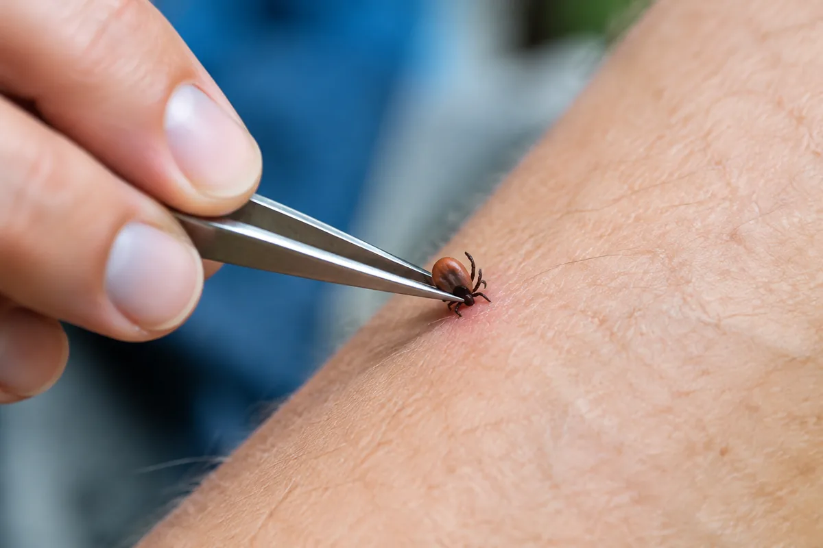 Comment retirer une tique sans laisser la tête dans la peau ?
